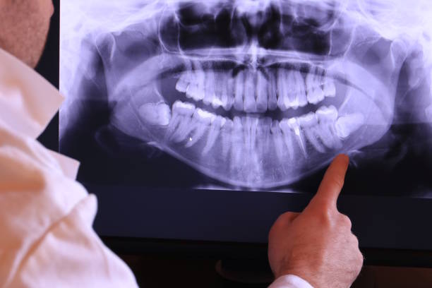 Best Root Canal Emergency Dentist  in Gosnell, AR